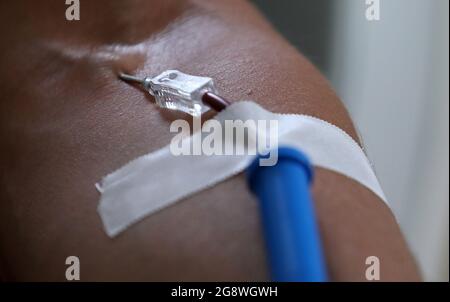 Rostock, Deutschland. Juli 2021. Blut wird im Blutspendezentrum des Universitätsklinikums gespendet. Das Universitätsklinikum richtet sich an die Bevölkerung mit einem Appell, der um Blutspenden bittet. Aufgrund des akuten Mangels an Blutspenden müssen die Operationen jeden Tag verschoben werden, die Corona-Krise hat den Blutmangel, der für einen Sommer normal ist, auf das Maximum verschärft. Quelle: Bernd Wüstneck/dpa-Zentralbild/ZB/dpa/Alamy Live News Stockfoto