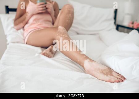 Dunkelhäutige Frau mit Hautpigmentierung im Bett liegend Stockfoto