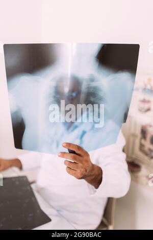 Leitender Arzt, der Röntgenaufnahmen im Krankenhaus untersucht Stockfoto