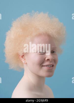 Studioporträt einer lächelnden Albino-Frau Stockfoto