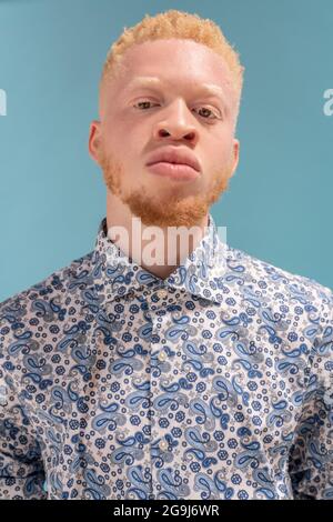 Studio-Porträt des Albino-Mannes in blau gemustertem Hemd Stockfoto