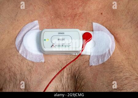 Der Holter-Herzmonitor an DER Brust eines männlichen kaukasischen Patienten zur Aufzeichnung der elektrischen Aktivität des Herzens für bis zu 72 Stunden misst Ihre Herzfrequenz. Stockfoto