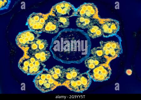 Gänseblümchen, Gänseblümchen, Englische Gänseblümchen (Bellis perennis), Querschnitt durch einen Blütenkopf mit Pollenbeutelchen und Pollen, Phasenkontrast-MRT, Stockfoto