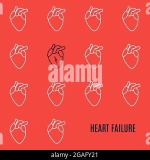 Herzinsuffizienz, konzeptionelle Illustration Stockfoto