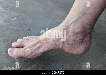 Südostasiatisch, Myanmar alte Frau Fuß der Seitenansicht. Hautfalten, lockere Haut und Adern zeigen Alterung. Isoliert auf Zementgrund. Stockfoto