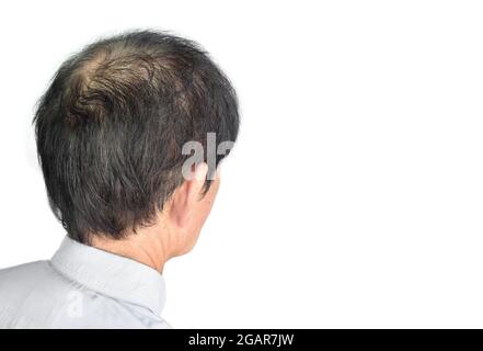 Dünner werdendes oder spärliches Haar, Haarausfall nach männlichem Muster im südostasiatischen, chinesischen älteren Mann. Mit Textbereich. Isoliert auf Weiß. Stockfoto