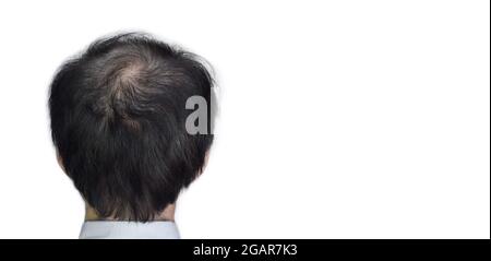 Dünner werdendes oder spärliches Haar, Haarausfall nach männlichem Muster im südostasiatischen, chinesischen älteren Mann. Mit Textbereich. Isoliert auf Weiß. Stockfoto