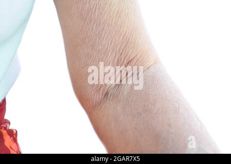 Alternde Hautfalten oder Hautfalten oder Falten an Arm und Unterarm südostasiatischer, chinesischer alter Frau. Stockfoto