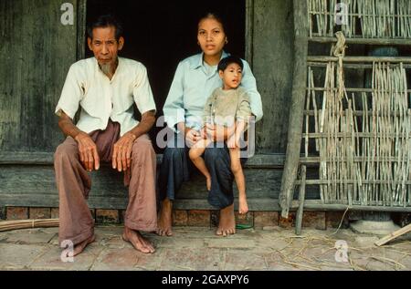 Quyen ist vier. Sie hat Mikrozephalie. Quens Vater, Nyguyen Van Quach, 35, kämpfte im Süden und wurde viele Male mit Agent Orange besprüht. Stockfoto