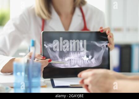 Ein professioneller Zahnarzt zeigt dem Patienten Röntgenaufnahmen von Kiefer und Zähnen mit einem digitalen Tablet Stockfoto