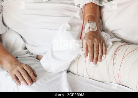 Verletzte alte Frau, die im Krankenhaus mit weißer Decke im Bett liegt. Nahaufnahme der Hände mit Venenkanüle und verbandtem Bein. Chirurgische Notfallbehandlung Stockfoto