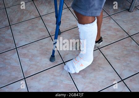 Nahaufnahme des Beines mit Gips Stockfoto