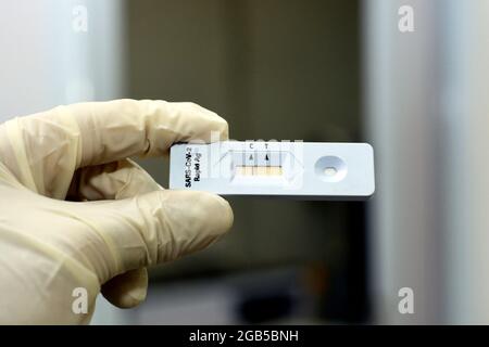 Negatives Ergebnis des SARS-CoV-2 Rapid Antigen AG-Tests, der von einem von medizinischem Personal gehaltenen Nasenabstrich durchgeführt wurde, Covid-19 Coronavirus Rapid Antigen-Testergebnis Stockfoto