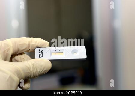 Negatives Ergebnis des SARS-CoV-2 Rapid Antigen AG-Tests, der von einem von medizinischem Personal gehaltenen Nasenabstrich durchgeführt wurde, Covid-19 Coronavirus Rapid Antigen-Testergebnis Stockfoto