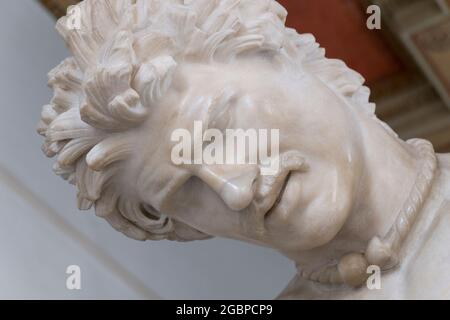 Eine Nahaufnahme, Detail des Steins, Marmorkopf der Skulptur, Statue des sterbenden Gallier, Galater. Im Kapitolinischen Museum in Rom, Italien. Stockfoto