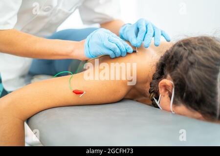 Ein Arzt, der Akupunkturnadeln in den Rücken einer Frau auf den Tisch legt Stockfoto