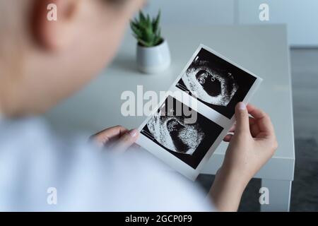 Rückansicht einer unbekannten, schwanger-kaukasischen Frau, die das Foto ihres ersten Ultraschalls der Babymütterlichkeit hält und anschaut Stockfoto