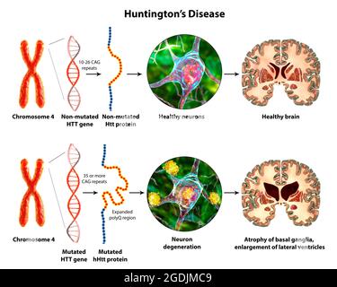 Molekulare Genese der Huntington-Krankheit, 3D-Illustration Stockfoto