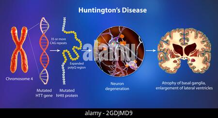 Molekulare Genese der Huntington-Krankheit, 3D-Illustration Stockfoto