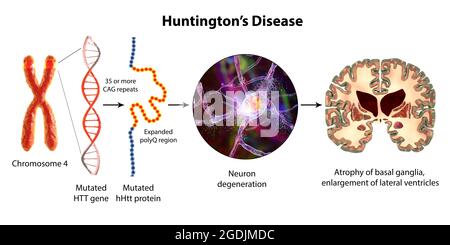 Molekulare Genese der Huntington-Krankheit, 3D-Illustration Stockfoto