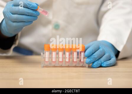 Ein Laborant hält einen Ständer mit Laborfroströhrchen in der einen Hand und einem Schlauch in der anderen Hand. Medizinisches und wissenschaftliches Konzept. Stockfoto