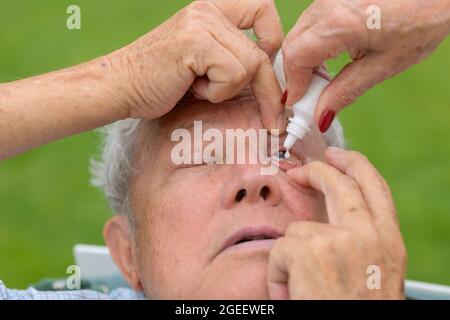 Frau, die bei einer Augenerkrankung Augenlider auf die Augen eines älteren Mannes in der Nähe aufbringt, während die Tropfen auf den unteren Deckel fallen Stockfoto