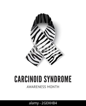 Karzinoid-Syndrom Awareness Ribbon Vector Illustration isoliert auf weißem Hintergrund. Realistische Zebrastreifen Farbband Konzept seltene Krankheit Stock Vektor
