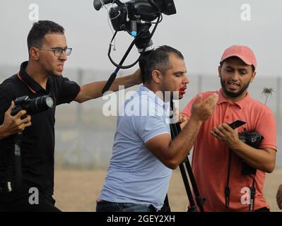 21. August 2012: Gaza, Palästina. 21. August 2021. Assem Shehadeh, ein Fotograf der National Agency, wird bei einer Demonstration im Flüchtlingslager Malika im Osten von Gaza City durch einen Schrapnel im Gesicht verletzt. Am 52. Jahrestag des Verbrennungsversuchs der Al-Aqsa-Moschee in Jerusalem kam es zu Zusammenstößen zwischen den Demonstranten und der israelischen Armee. Nach Angaben des Gesundheitsministeriums von Gaza wurden während der Zusammenstöße mehr als 40 Palästinenser von israelischen Truppen verletzt, darunter zwei von ihnen, darunter ein 13-jähriger Junge. Ein israelischer Soldat wurde ebenfalls während des Ereignisses verletzt ( Stockfoto