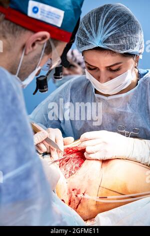 Ein Team von Chirurgen kämpft um das Leben und führt eine komplexe Operation in einem modernen Operationssaal durch. Stockfoto