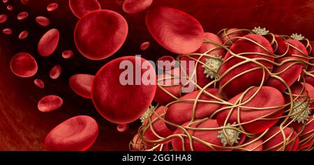 Blutgerinnsel und Thrombose medizinisches Illustrationskonzept als eine Gruppe von menschlichen Blutzellen, die durch klebrige Thrombozyten und Fibrin zusammen verklumpt bilden. Stockfoto