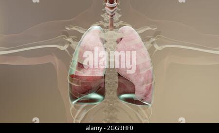 3d-Darstellung von Hämopneumothorax, normaler Lunge versus kollabiert, Symptome von Hämopneumothorax, Pleuraerguss, Empyema, Komplikationen Stockfoto