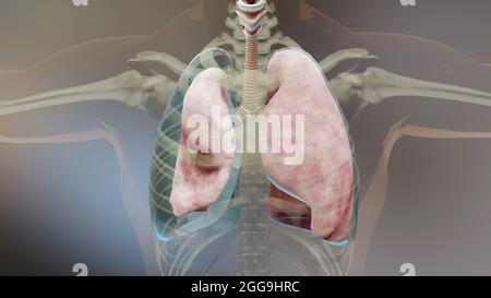 3d-Darstellung des Pneumothorax, normale Lunge versus kollabiert, Symptome des Pneumothorax, Pleuraerguss, Empyema, Komplikationen nach einer Brustverletzung Stockfoto
