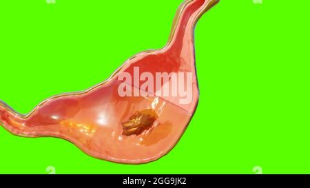 3d-Illustration der Anatomie des menschlichen Magens Verdauung, 3D-Reibe Stockfoto
