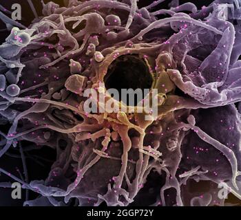 Koloriertes Rasterelektronenmikrograph einer mit UK B infizierten Zelle (violett) Stockfoto