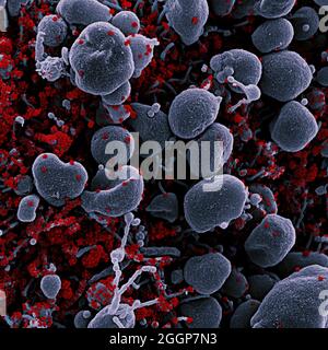 Eingefärbtes Rasterelektronenmikrograph einer apoptotischen Zelle (grau), die stark mit SARS-CoV-2-Viruspartikeln (rot) infiziert ist und aus einer Patientenprobe isoliert wurde. Stockfoto