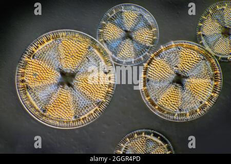 Hetiopelta Leeuwenhoekii, Maryland, USA, DIC-Beleuchtung Stockfoto