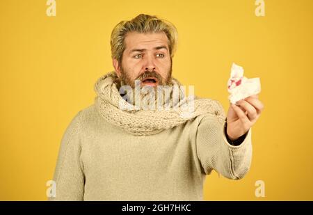 oh nein Lungenkrebsbewusstsein. Coronavirus aus china. Der Mensch hustet blutig. Lungenentzündung. Kranker Mann bekam eine Virusinfektion. Gesundheit. Mann schlecht Stockfoto