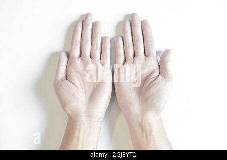 Blasse Palmaroberfläche beider Hände. Anämische Hände eines asiatischen, chinesischen Mannes. Stockfoto