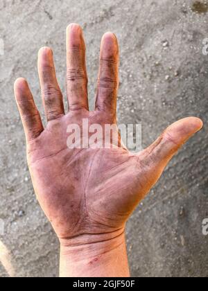 Schmutzige Handfläche der rechten Hand des südostasiatischen Arbeiters. Hautfalten sind offensichtlich. Stockfoto