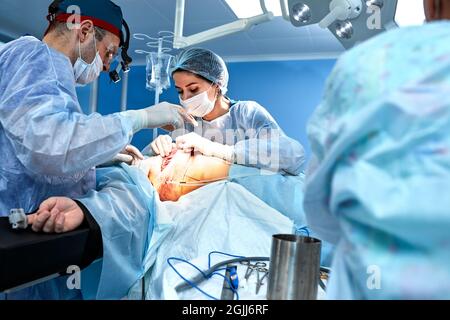 Ein Team von Chirurgen kämpft um das Leben und führt eine komplexe Operation in einem modernen Operationssaal durch. Stockfoto