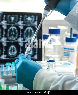 Alzheimer- und Demenzforschung Stockfoto