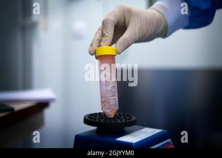 Labor zur Entwicklung therapeutischer Impfstoffe zur Behandlung von Lungenkrebs durch Stimulierung des Immunsystems. Stockfoto