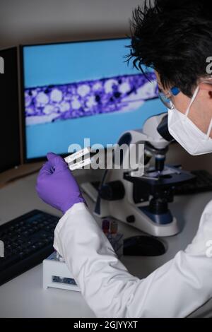 Bluttest auf Syphilis, verursacht durch das Bakterium treponema pallidum oder blasses treponema. Diese Infektion wird sexuell übertragen. Stockfoto