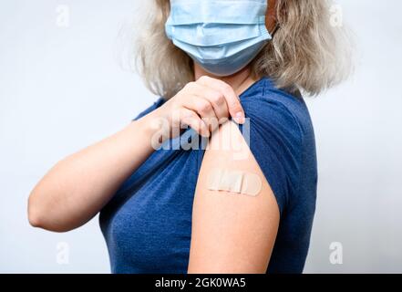 Geimpfte junge Frau mit Gipsschulter, weibliche Person in Maske nach Erhalt des COVID-19-Impfstoffs. Konzept der Impfung gegen das Corona-Virus Stockfoto
