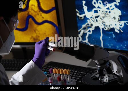 Bluttest auf Syphilis, verursacht durch das Bakterium treponema pallidum oder blasses treponema. Diese Infektion wird sexuell übertragen. Stockfoto