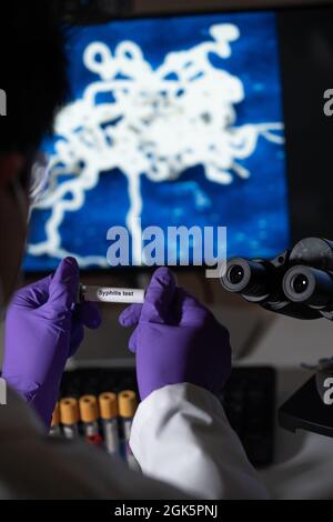 Bluttest auf Syphilis, verursacht durch das Bakterium treponema pallidum oder blasses treponema. Diese Infektion wird sexuell übertragen. Stockfoto