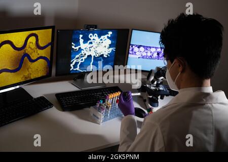 Bluttest auf Syphilis, verursacht durch das Bakterium treponema pallidum oder blasses treponema. Diese Infektion wird sexuell übertragen. Stockfoto