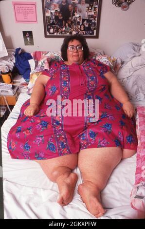 Killeen Texas USA, 1993: Krankhaft übergewichtige Frau mit einem Gewicht von über 600 kg, die aufgrund ihrer Unfähigkeit, sich sicher in ihrem Haus zu bewegen, ins Bett gesperrt wurde. HERR ©Daemmrich Stockfoto