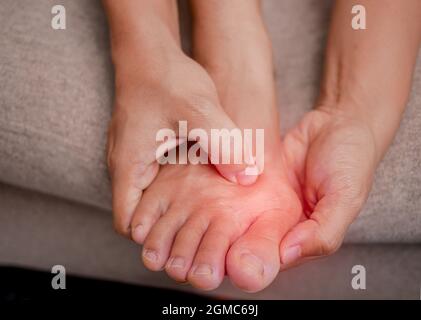 Nahaufnahme einer Frau, die ihre schmerzhaften Füße hält und ihre Bunion-Zehen massiert, um Schmerzen zu lindern. Geschwollene Bunion am Rand der Großzehe verursacht Deformität ( Stockfoto