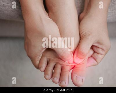 Nahaufnahme einer Frau, die ihre schmerzhaften Füße hält und ihre Bunion-Zehen massiert, um Schmerzen zu lindern. Geschwollene Bunion am Rand der Großzehe verursacht Deformität ( Stockfoto